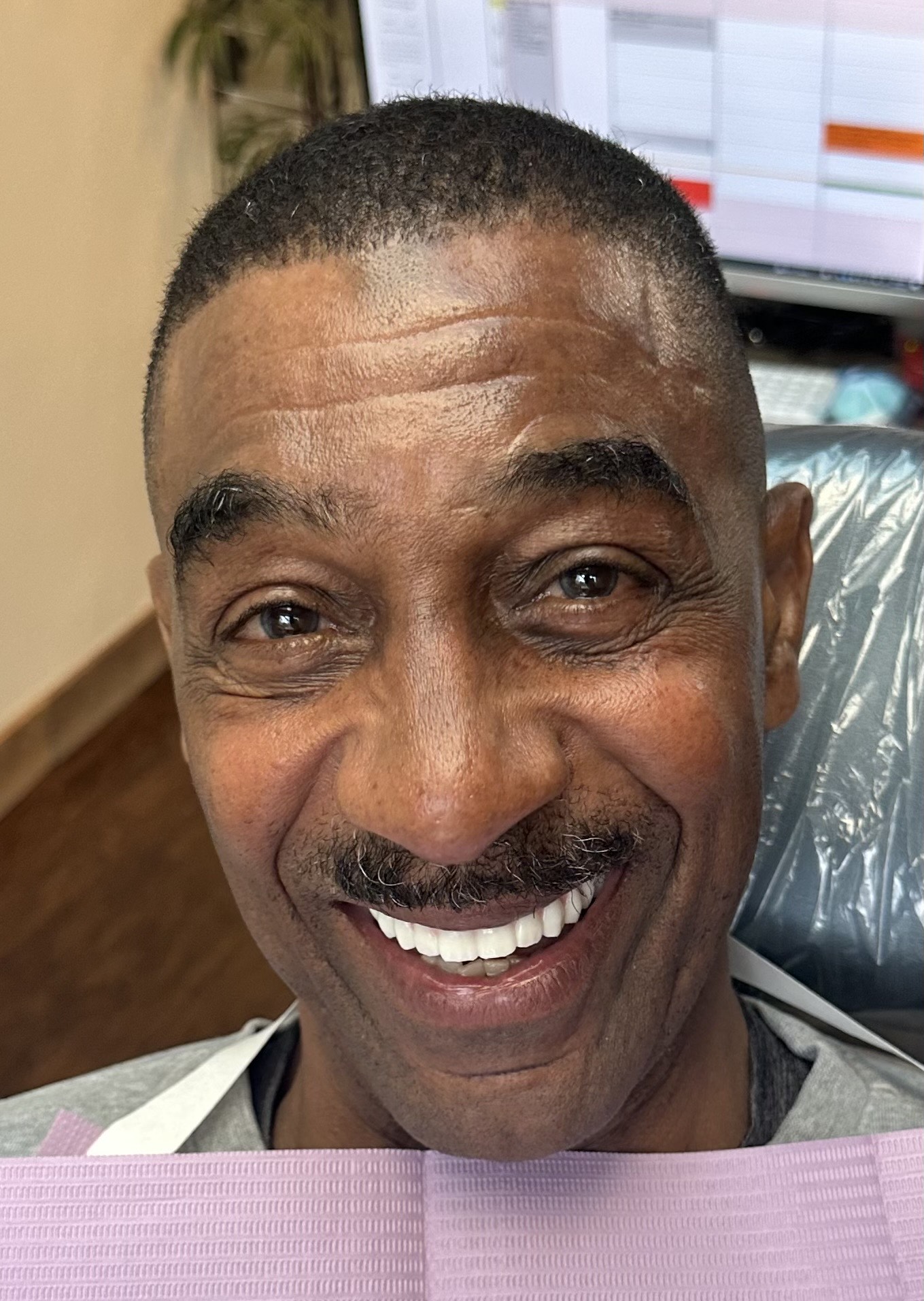 Patient smile after dental implant treatment, case 3